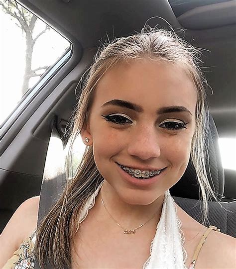 braces girl leaked|r/bracesgirl5